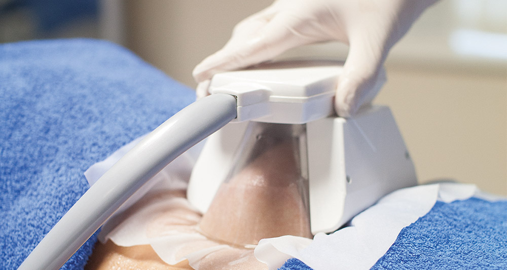 How Fat Freezing and HIFU Work Together? 2 Multiple Areas in One Session HIFU and Fat Freezing Trowbridge