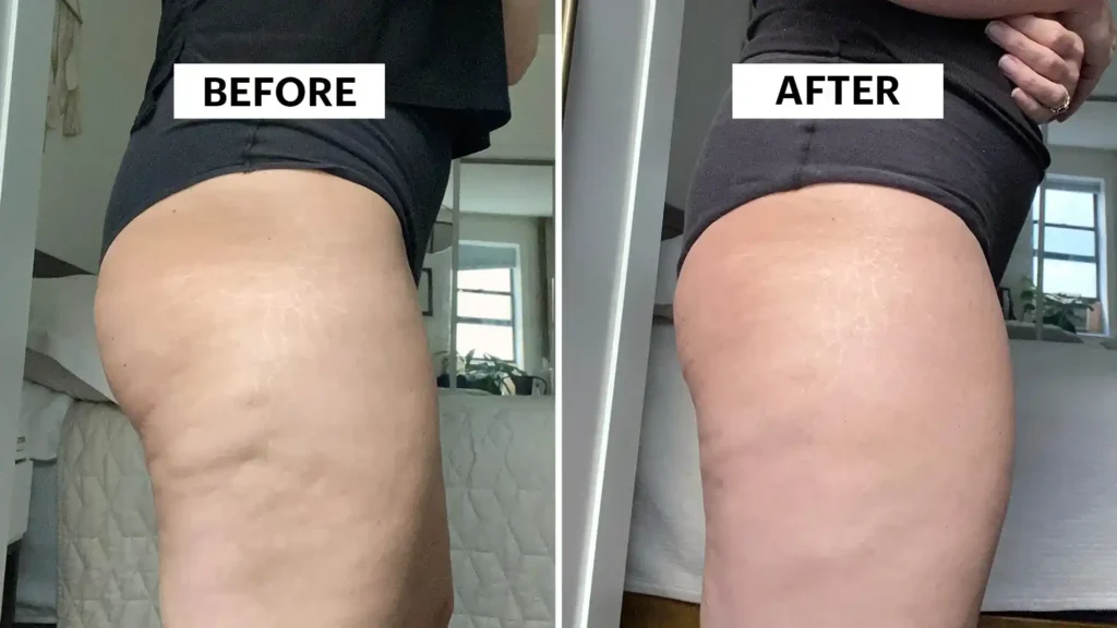 Do Toning Exercise Trowbridge Really Tackle Cellulite?