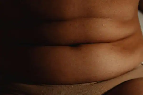 The Hidden Connection: How Stress Shapes Your Fitness and Body Composition 3 image of what stress can do on the stomach area and how Lipo 360 Trowbridge can help to change your body shape.